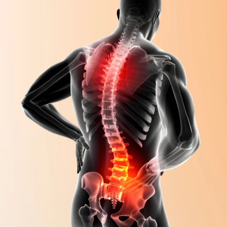 Scoliosis: Spinal Curvature Diagnosis and Treatment with Dr. Hazem El Fezary