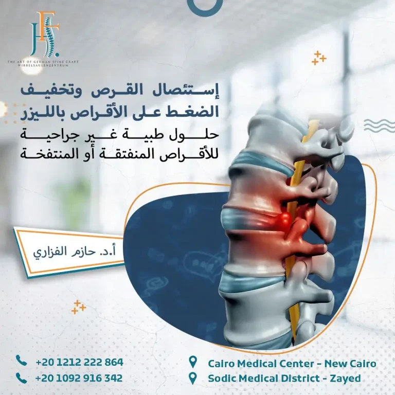 استئصال القرص بالليزر وتخفيف الضغط على الأقراص بالليزر